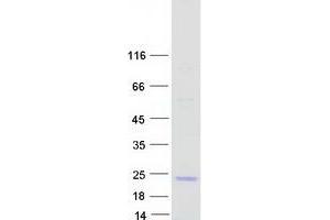 Western Blotting (WB) image for Odorant Binding Protein 2A (OBP2A) protein (Myc-DYKDDDDK Tag) (ABIN2727876)