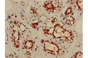 Immunohistochemistry (IHC) image for anti-Nucleolar Protein 3 (Apoptosis Repressor with CARD Domain) (NOL3) (AA 1-208) antibody (ABIN7161970)