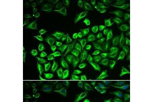 Immunofluorescence analysis of A549 cells using HAS3 Polyclonal Antibody (HAS3 抗体)