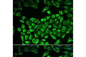 Immunofluorescence analysis of A549 cells using HAS3 Polyclonal Antibody (HAS3 抗体)
