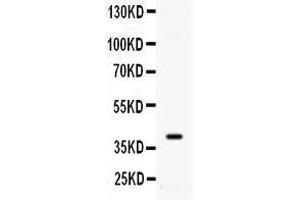 Western blot analysis of ADK using anti- ADK antibody .