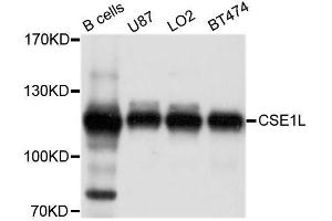 Western blot analysis of extracts of various cell lines, using CSE1L antibody. (Exportin 2 抗体  (AA 50-150))