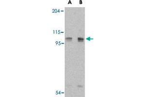 Western blot analysis of AOF2 in P815 cell lysate with AOF2 polyclonal antibody  at (A) 1 and (B) 2 ug/mL . (LSD1 抗体  (Internal Region))