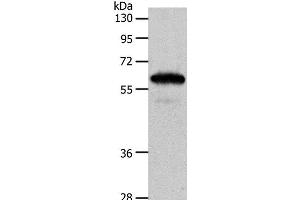 Western Blot analysis of Mouse brain tissue using INA Polyclonal Antibody at dilution of 1:550 (INA 抗体)