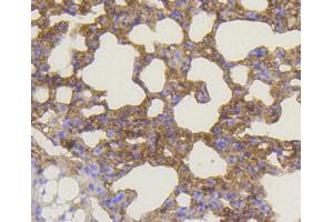 Immunohistochemistry of paraffin-embedded mouse lung using BAK1 antibody (ABIN4903006) at dilution of 1:100 (40x lens). (BAK1 抗体)
