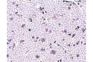 Immunohistochemistry (IHC) image for anti-Cerebral Dopamine Neurotrophic Factor (CDNF) (N-Term) antibody (ABIN1031315) (CDNF 抗体  (N-Term))