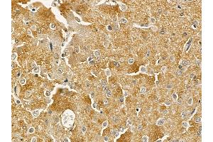OR51B5 Mouse Monoclonal Antibody at 1/100 staining rat brain tissue by IHC-P.