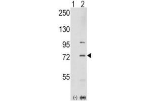 Western blot analysis of PAK1 antibody and 293 cell lysate either nontransfected (Lane 1) or transiently transfected with the PAK1 gene (2). (PAK1 抗体  (AA 401-430))