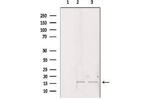 Western blot analysis of extracts from various samples, using CHCHD2 antibody. (CHCHD2 抗体  (Internal Region))