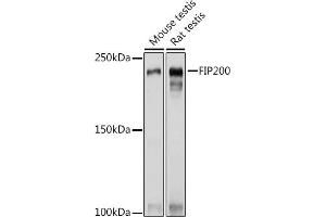 Western blot analysis of extracts of various cell lines, using FIP200 Rabbit pAb (ABIN7269881) at 1:1000 dilution. (FIP200 抗体  (C-Term))