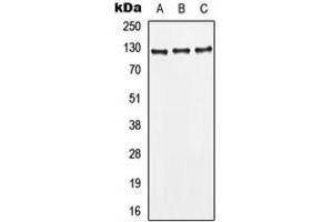 Western blot analysis of CD295 expression in MCF7 (A), HepG2 (B), HeLa (C) whole cell lysates. (Leptin Receptor 抗体  (Center))
