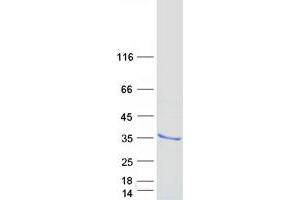 Validation with Western Blot