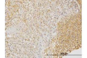 Image no. 1 for anti-Dihydropyrimidinase-Like 3 (DPYSL3) (AA 457-556) antibody (ABIN598653) (DPYSL3 抗体  (AA 457-556))