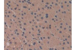 Detection of COX 2 in Human Liver Tissue using Polyclonal Antibody to Cyclooxygenase-2 (COX 2) (COX2 抗体  (AA 418-589))