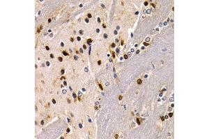 Immunohistochemistry (Paraffin-embedded Sections) (IHC (p)) image for anti-SRY (Sex Determining Region Y)-Box 2 (SOX2) (AA 1-140) antibody (ABIN3021003)