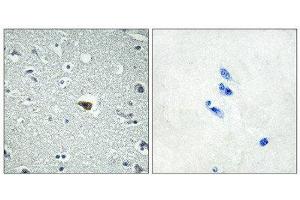 Immunohistochemistry (IHC) image for anti-Brain-Specific Angiogenesis Inhibitor 1 (BAI1) (Internal Region) antibody (ABIN6301192) (BAI1 抗体  (Internal Region))
