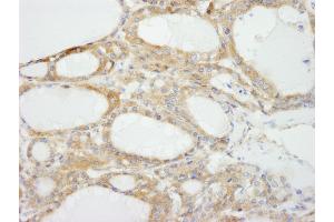 anti-Neurofibromin 2 (NF2) (C-Term) antibody