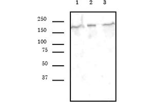 SMARCA4 antibody (mAb) (Clone 5B7) tested by Western blot. (SMARCA4 抗体  (AA 213-295))