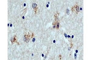 DAB staining of ATG5 in paraffin - embedded human brain section (midfrontal cortex, Alzheimer case) using rabbit ATG5 polyclonal antibody  . (ATG5 抗体  (C-Term))