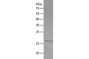 CKM Protein (AA 1-162) (His tag)