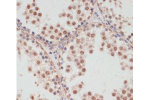 Immunohistochemistry of paraffin-embedded Rat testis using Phospho-PEA15(S104) Polyclonal Antibody at dilution of 1:100 (40x lens). (PEA15 抗体  (pSer104))