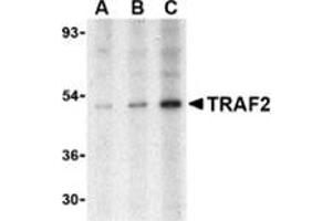 Western blot analysis of TRAF2 in human liver tissue lysate with this product at (A) 0. (TRAF2 抗体  (N-Term))