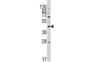 Western blot analysis of APOA5 antibody and HL-60 lysate. (APOA5 抗体  (AA 22-52))