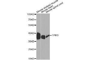 Western blot analysis of extracts of various cell lines, using TPM3 antibody (ABIN1875182) at 1:1000 dilution. (TPM3 抗体)
