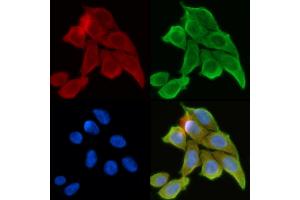 ABIN6260885 and ABIN6268761 staining Hela cells(30 min of UV treatment) by IF/ICC.