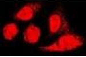 Immunofluorescent analysis of PA28 alpha staining in U2OS cells. (PSME1 抗体)