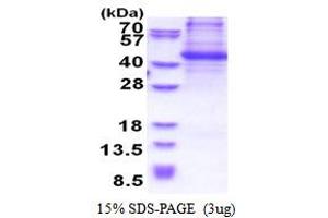 SDS-PAGE (SDS) image for Breast Cancer Anti-Estrogen Resistance 1 (BCAR1) (AA 465-848) protein (His tag) (ABIN5853517)