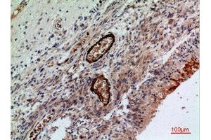 Immunohistochemistry (IHC) image for anti-Rh Family A Glycoprotein (RHAG) (N-Term) antibody (ABIN3181013)