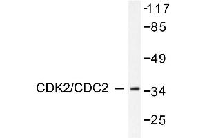 Image no. 1 for anti-Cyclin-Dependent Kinase 2 (CDK2) antibody (ABIN265345) (CDK2 抗体)