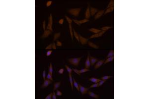 Immunofluorescence analysis of NIH/3T3 cells using PFKFB3 Rabbit mAb (ABIN1680620, ABIN3018306, ABIN3018307 and ABIN7101590) at dilution of 1:100 (40x lens). (PFKFB3 抗体)