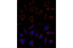 Immunofluorescence analysis of L929 cells using TBRG4 antibody  at dilution of 1:100. (TBRG4 抗体  (AA 382-631))