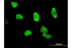 Immunofluorescence (IF) image for anti-Cleavage and Polyadenylation Specific Factor 6, 68kDa (CPSF6) (AA 37-136) antibody (ABIN524445)