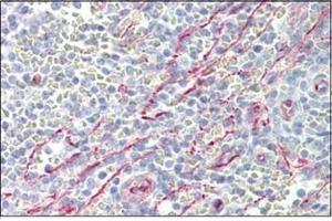 Immunohistochemistry (Paraffin-embedded Sections) (IHC (p)) image for anti-Solute Carrier Family 25 (Mitochondrial Oxodicarboxylate Carrier), Member 21 (Slc25a21) (Internal Region) antibody (ABIN1449747)