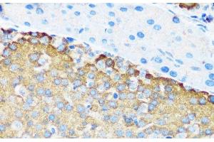 Immunohistochemistry of paraffin-embedded Mouse pancreatic islet using TSC1 Polyclonal Antibody at dilution of 1:200 (40x lens). (TSC1 抗体)