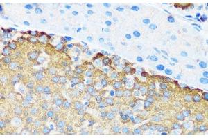 Immunohistochemistry of paraffin-embedded Mouse pancreatic islet using TSC1 Polyclonal Antibody at dilution of 1:200 (40x lens).