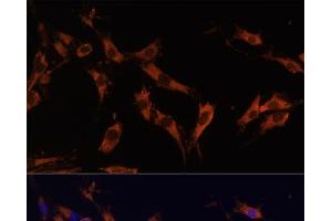 Immunofluorescence analysis of C6 cells using KSR1 Polyclonal Antibody at dilution of 1:100 (40x lens). (KSR1 抗体)