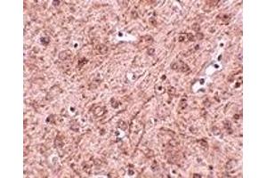 Immunohistochemistry (IHC) image for anti-Ceramide Synthase 6 (CERS6) (N-Term) antibody (ABIN1031437) (CERS6 抗体  (N-Term))