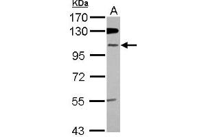 Western Blotting (WB) image for anti-Zinc Finger Protein 512B (ZNF512B) (Internal Region) antibody (ABIN1493532) (ZNF512B 抗体  (Internal Region))