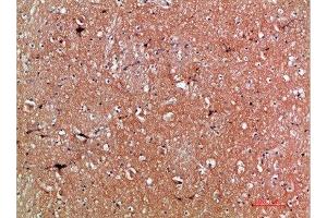 Immunohistochemical analysis of paraffin-embedded human-brain, antibody was diluted at 1:200 (Tenascin R 抗体  (AA 1270-1350))