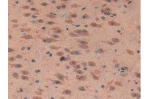 Detection of IGFBP7 in Mouse Cerebrum Tissue using Polyclonal Antibody to Insulin Like Growth Factor Binding Protein 7 (IGFBP7) (IGFBP7 抗体  (AA 88-281))