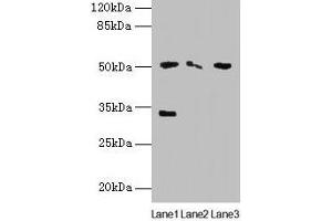 Western blot All lanes: SLC38A6 antibody at 12 μg/mL Lane 1: Mouse kidney tissue Lane 2: Mouse thymus tissue Lane 3: U87 whole cell lysate Secondary Goat polyclonal to rabbit IgG at 1/10000 dilution Predicted band size: 51, 58 kDa Observed band size: 51, 33 kDa (SLC38A6 抗体  (AA 132-169))
