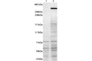 Western Blotting (WB) image for anti-Neurobeachin (NBEA) antibody (ABIN5872883) (Neurobeachin 抗体)