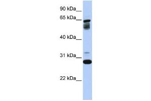 Western Blotting (WB) image for anti-Transmembrane Protein 187 (TMEM187) antibody (ABIN2458936) (TMEM187 抗体)