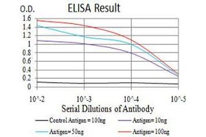 Black line: Control Antigen (100 ng),Purple line: Antigen (10 ng), Blue line: Antigen (50 ng), Red line:Antigen (100 ng) (DDX5 抗体  (AA 475-614))