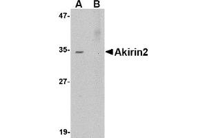Western Blotting (WB) image for anti-Akirin 2 (AKIRIN2) (Middle Region 2) antibody (ABIN1031196) (AKIRIN2 抗体  (Middle Region 2))