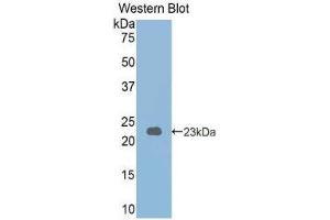 Western Blotting (WB) image for anti-phosphorylase, Glycogen, Liver (PYGL) (AA 341-509) antibody (ABIN1173786) (PYGL 抗体  (AA 341-509))